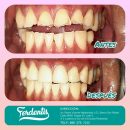 operatoria dental operatoria dental