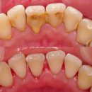 periodoncia periodoncia