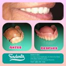 rehabilitacion oral rehabilitacion oral